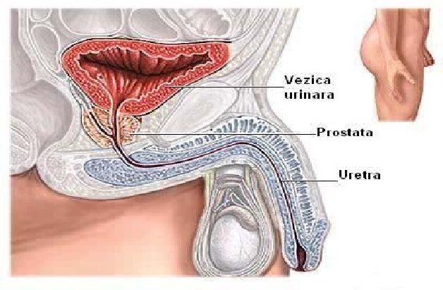 Prostatita sau inflamatia prostatei: cauze, simptome, tratament